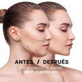 FaceLift Pro